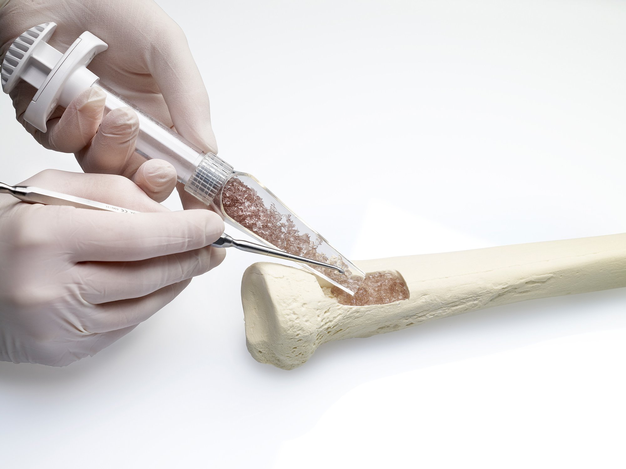 Granules application_bone_MR_RGB Granules application_bone_MR_RGB
