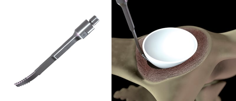 sonde-courbe-combinee