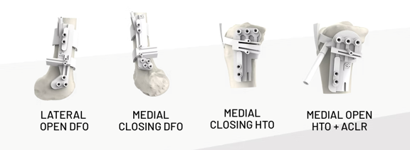 Osteotomy Indikationen