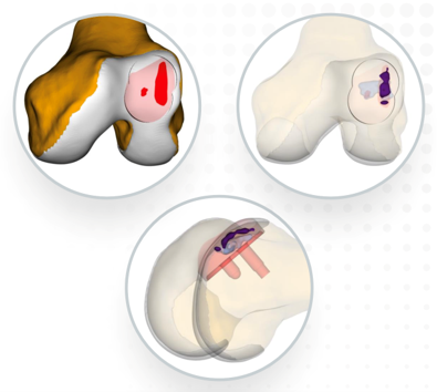 damage marking report_ knee